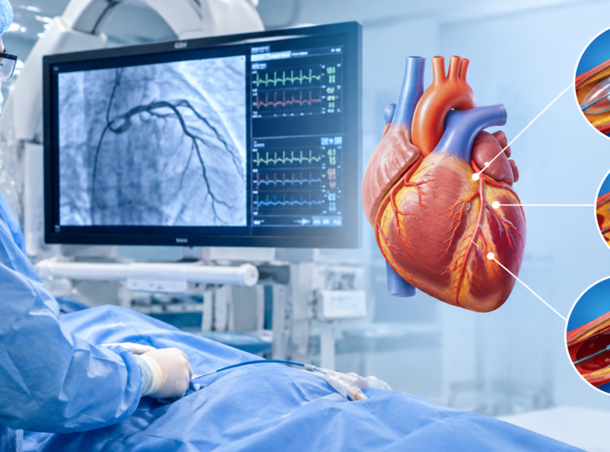 When Is Interventional Cardiology Needed? Understanding Common Heart Procedures hd